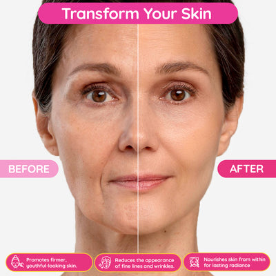 before and after of using collagen gummies skin transformation. gummies supplement